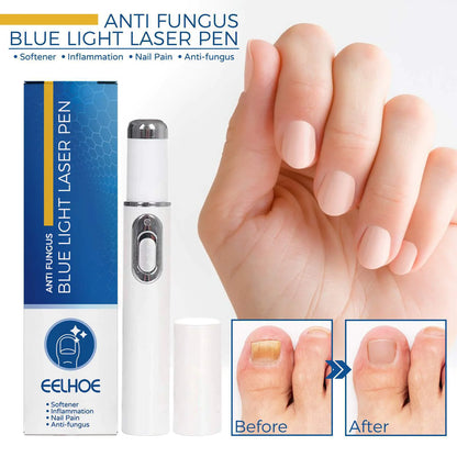 Nail Blue Light Laser Treatment Pen