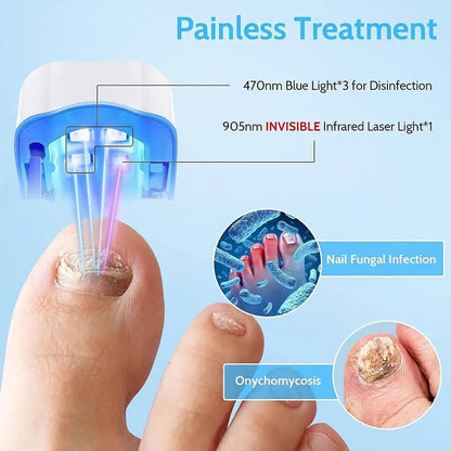 Nail Fungus Laser