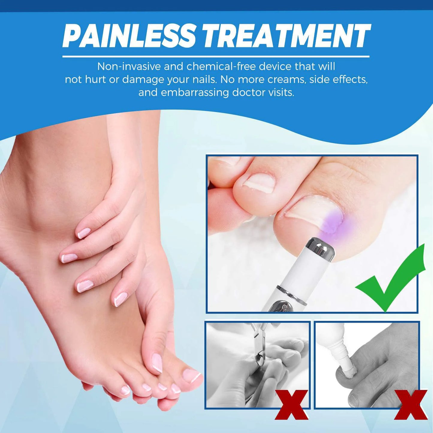 Nail Blue Light Laser Treatment Pen